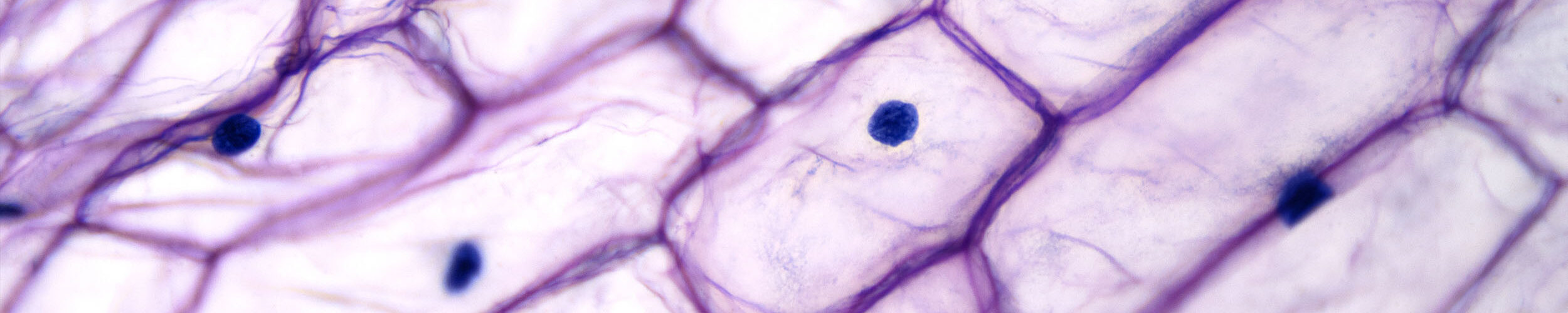 especialidades tratamiento de aguas